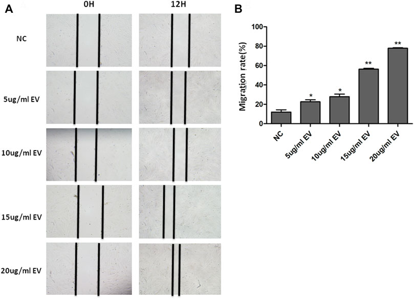 hMSC-Exosomes enhance fibroblast migration in a dose-dependent manner shown by scratch assay and microscopy.